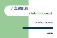 子宫腺肌病
