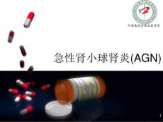 急性肾小球肾炎