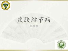 结节病11221