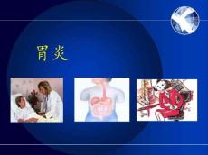 急慢性胃炎