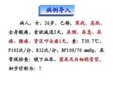 肾盂肾炎课件