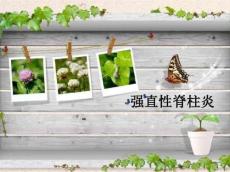 强直性脊柱炎14238
