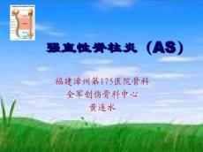 强直性脊柱炎14274