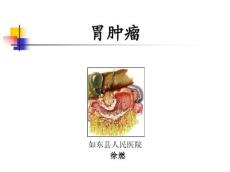 胃癌29133