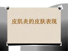 皮肌炎临床表现