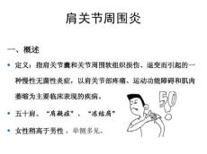 肩周炎23394