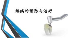 龋齿的治疗