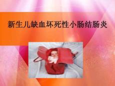 新生儿缺血坏死性小肠结肠炎
