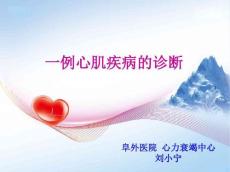 巨细胞心肌炎