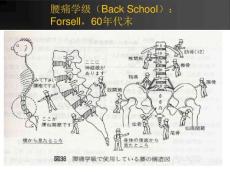 腰腿痛的康复