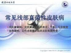皮肤病学之常见真菌性皮肤病
