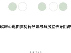 临床心电图窦房传导阻滞与房室传导阻滞