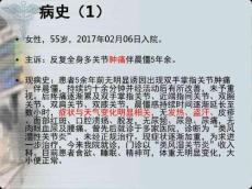 类风湿性关节炎1153
