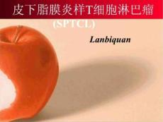 皮下脂膜炎样T细胞淋巴瘤