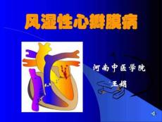 风湿性心脏病 讲课.