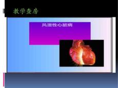 风湿性心脏病