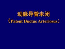 动脉导管未闭PPT课件
