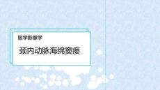 (260)--颈动脉海绵窦瘘