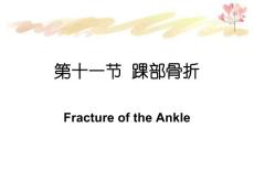 踝部骨折踝部扭伤