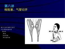 2023年医学知识—喉阻塞