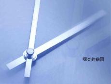 咽炎的病因