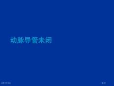 动脉导管未闭