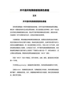 并不是所有黑痣都是黑色素瘤
