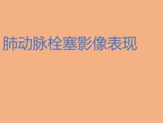 肺动脉栓塞 影像