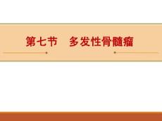 多发性骨髓瘤