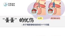 精索静脉曲张科普幻灯