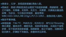特发性血小板减少性紫癜课件