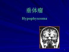 垂体瘤脑转移瘤课件