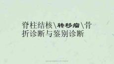 脊柱结核转移瘤骨折诊断与鉴别诊断ppt课件