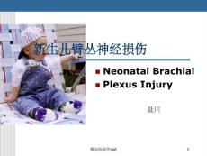 新生儿臂丛神经损伤课件