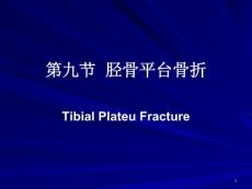 讲胫骨平台骨折讲胫腓骨骨干骨折课件