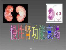 慢性肾功能衰竭课件