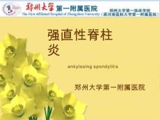 强直性脊柱炎-课件