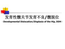 发育性髋关节发育不良髋脱位