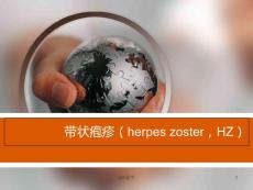 带状疱疹--课件