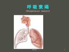呼吸衰竭 -课件