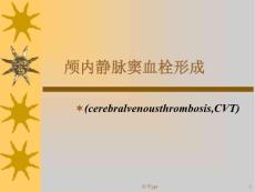 颅内静脉窦血栓形成课件