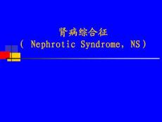 肾病综合征