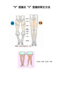 O型腿和型腿的矫正方法