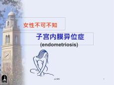 子宫内膜异位症-课件