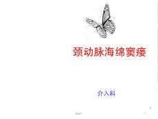 颈动脉海绵窦瘘的护理教学查房【介入科】-课件