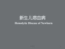 新生儿溶血病--课件
