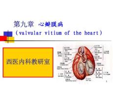 心瓣膜病课件