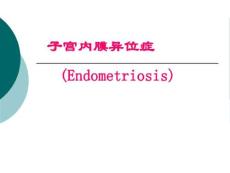 子宫内膜异位症课件