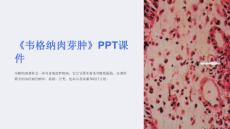 《韦格纳肉芽肿》课件