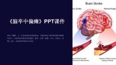 《脑卒中偏瘫》课件